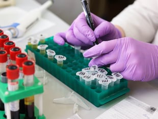 Bookings now being taken for Launceston blood testing evening