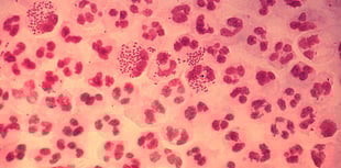 Young people urged to have sex safely as STI rates rocket 