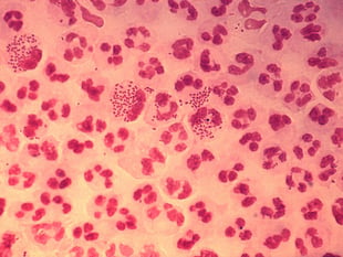 Young people urged to have sex safely as STI rates rocket 
