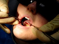 Almost 100 hospital admissions in Cornwall to remove children's rotten teeth