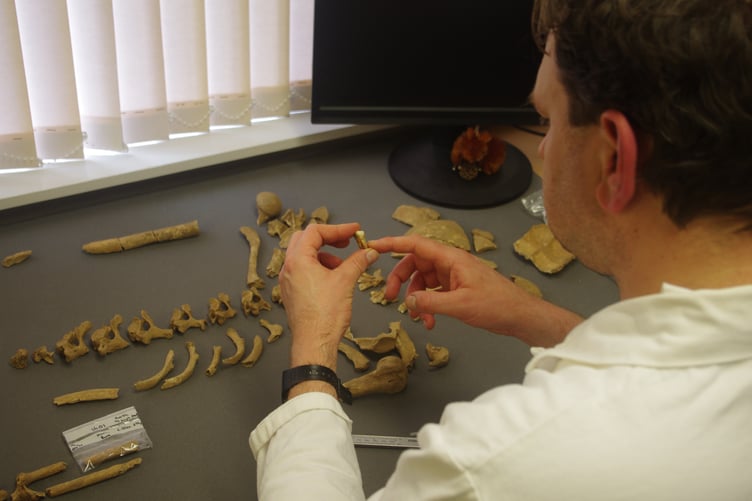 The bones were examined