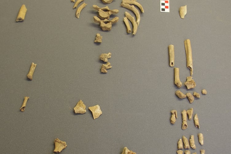 One of the bodies bones laid out on display