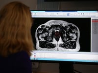 More men diagnosed with prostate cancer in Cornwall and the Isles of Scilly