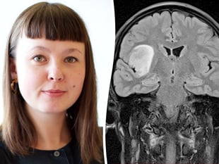 Artist documents her brain tumour health journey